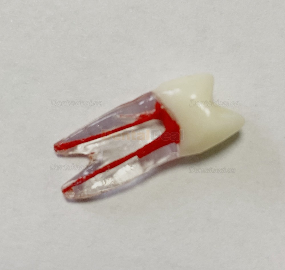 Dental Teeth Practice Model Endo File Molar Upper Lower Tooth Premolar Root 2/3-Rooted Canal